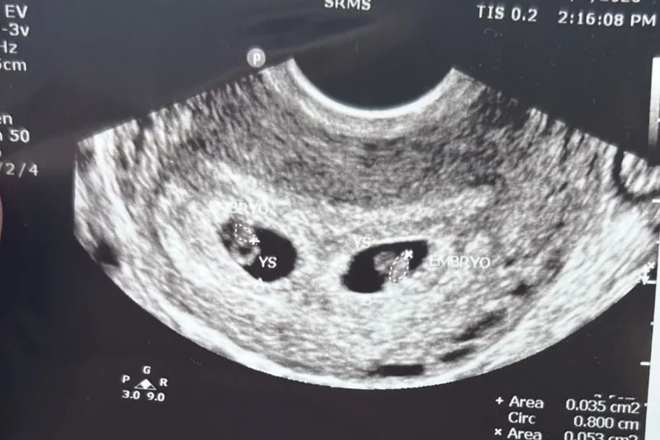 Karoline 的 Premom 好孕故事